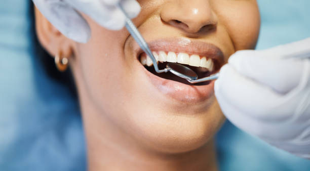 Best Urgent Dental Care for Toothache in Chula Vista, TX