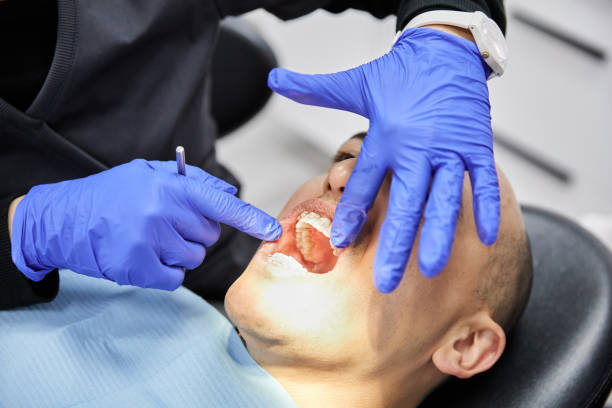 Best Emergency Root Canal Treatment in Chula Vista, TX